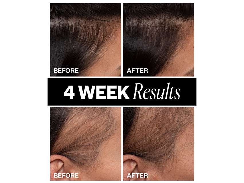 IGK Sponsored Hair Density Scalp Treatment