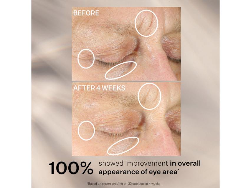 ダイアモンド11+Centuary Eye cream 20g 2本セット StriVectin-SD Eye Concentrate for Wrinkles PLUS | LovelySkin